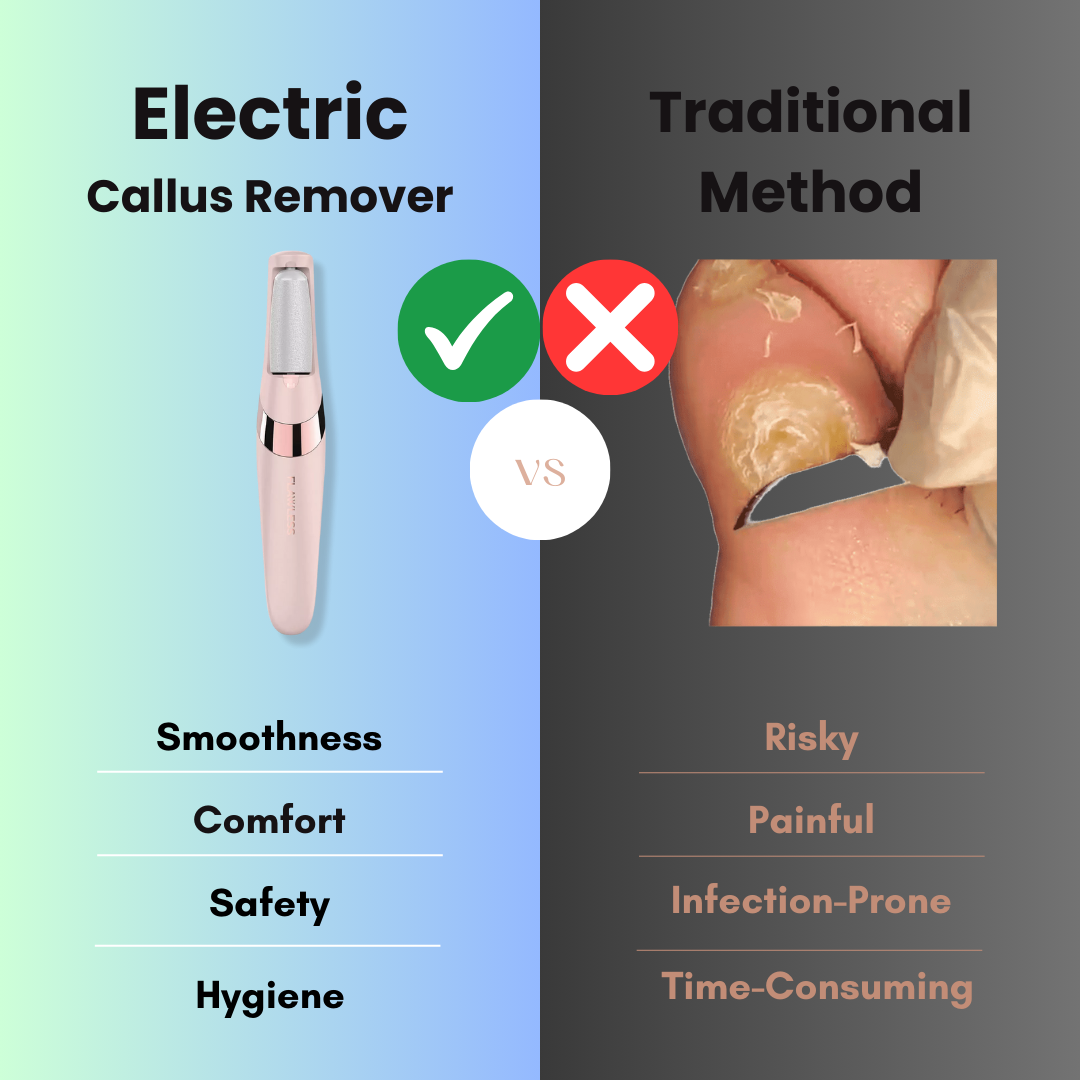 Automatic Electric Foot Callus Remover